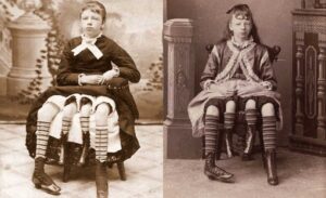 Josephine Myrtle Corbin, FOTO: James R. Applegate (1849–1910), Philadelphia, Public domain, via Wikimedia Commons Charles Eisenmann (1855-1927), Public domain, via Wikimedia Commons