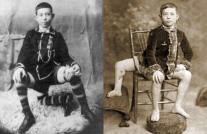 F. Lentini, FOTO: http://www.sideshowworld.com/FL-3leg-5.JPG, Public domain, via Wikimedia Commons